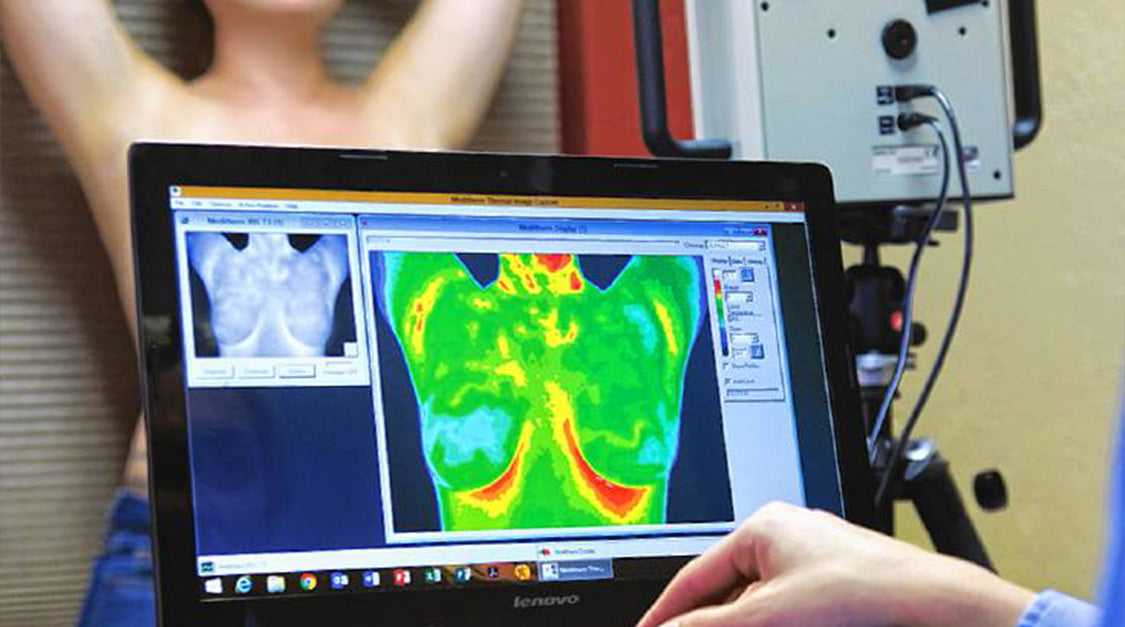What is Thermography?