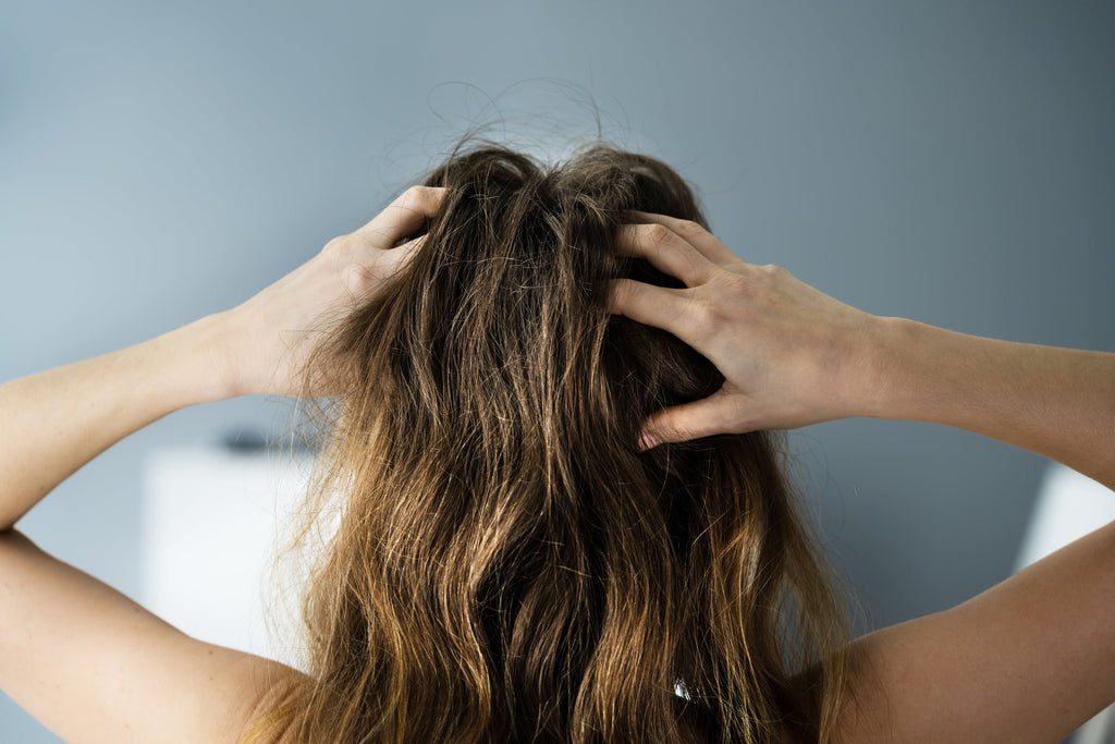 Menopausal Hair Loss: Causes, Myths, and Natural Treatments
